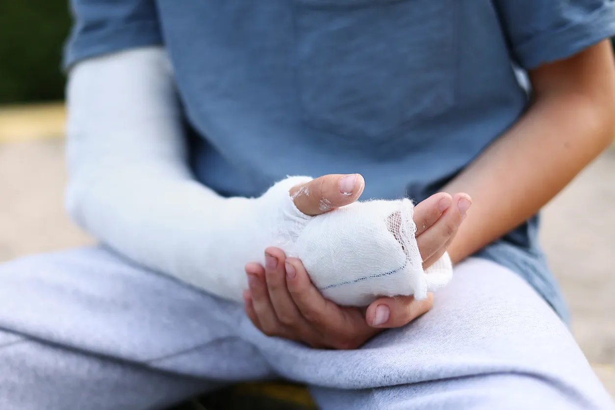 man holding his injured arm in a cast.