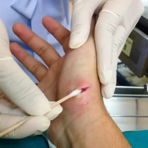 Is My Relationship with the Dog Owner Important for a Claim?