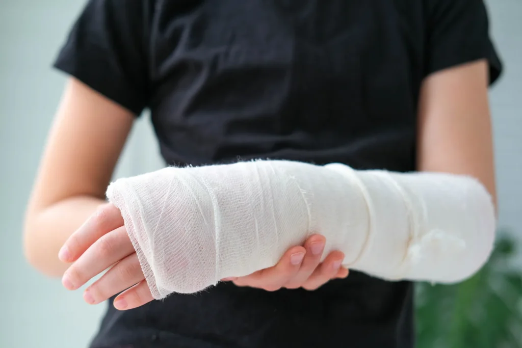 A person holding their injured arm.